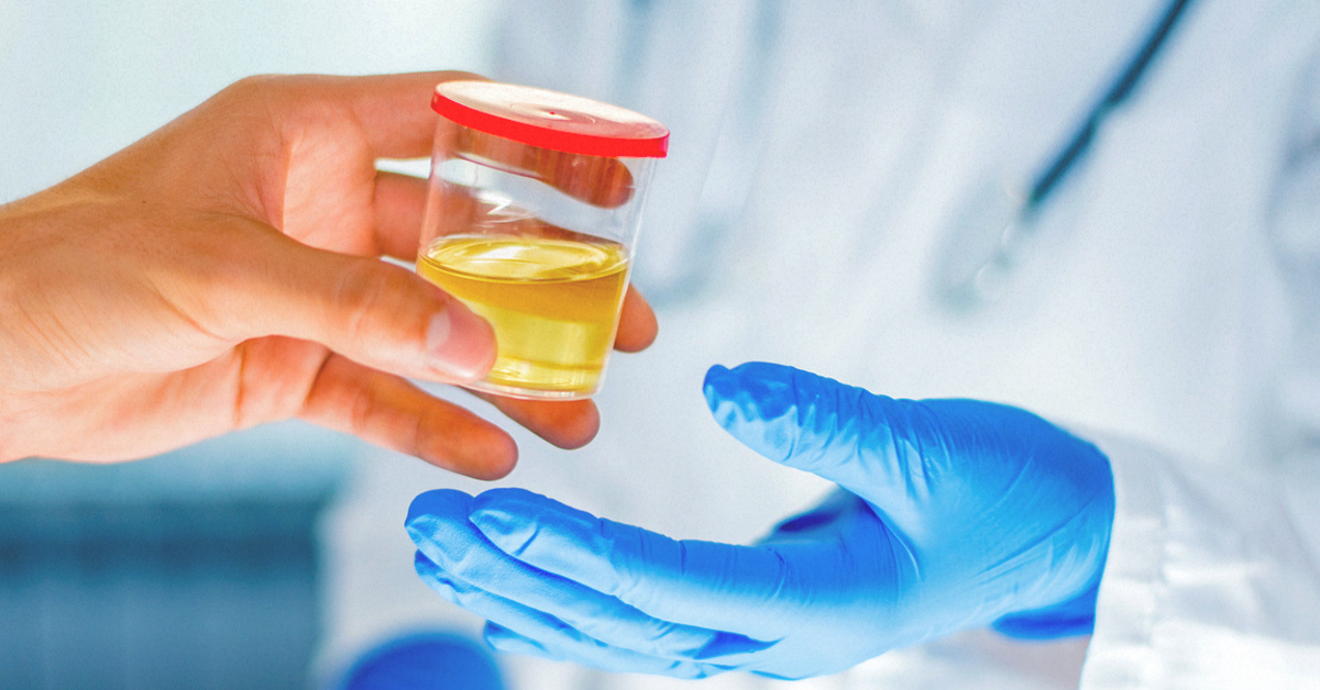 Buy The Best Quality Synthetic Urine